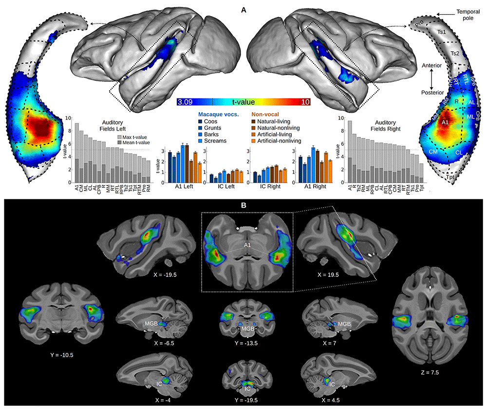 Functional mapping of auditory responses... | Open Research Europe